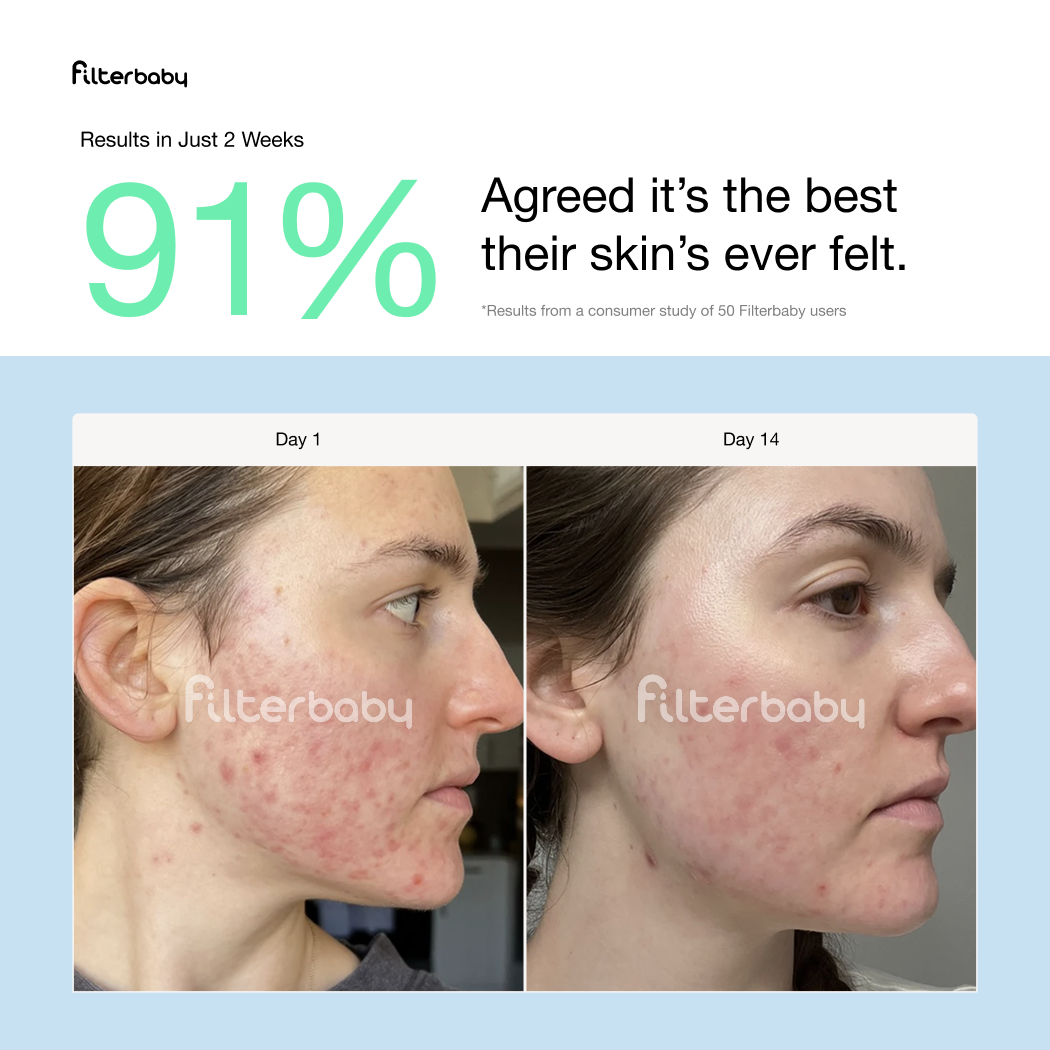 Filterbaby Skincare Faucet Filter 2.0
