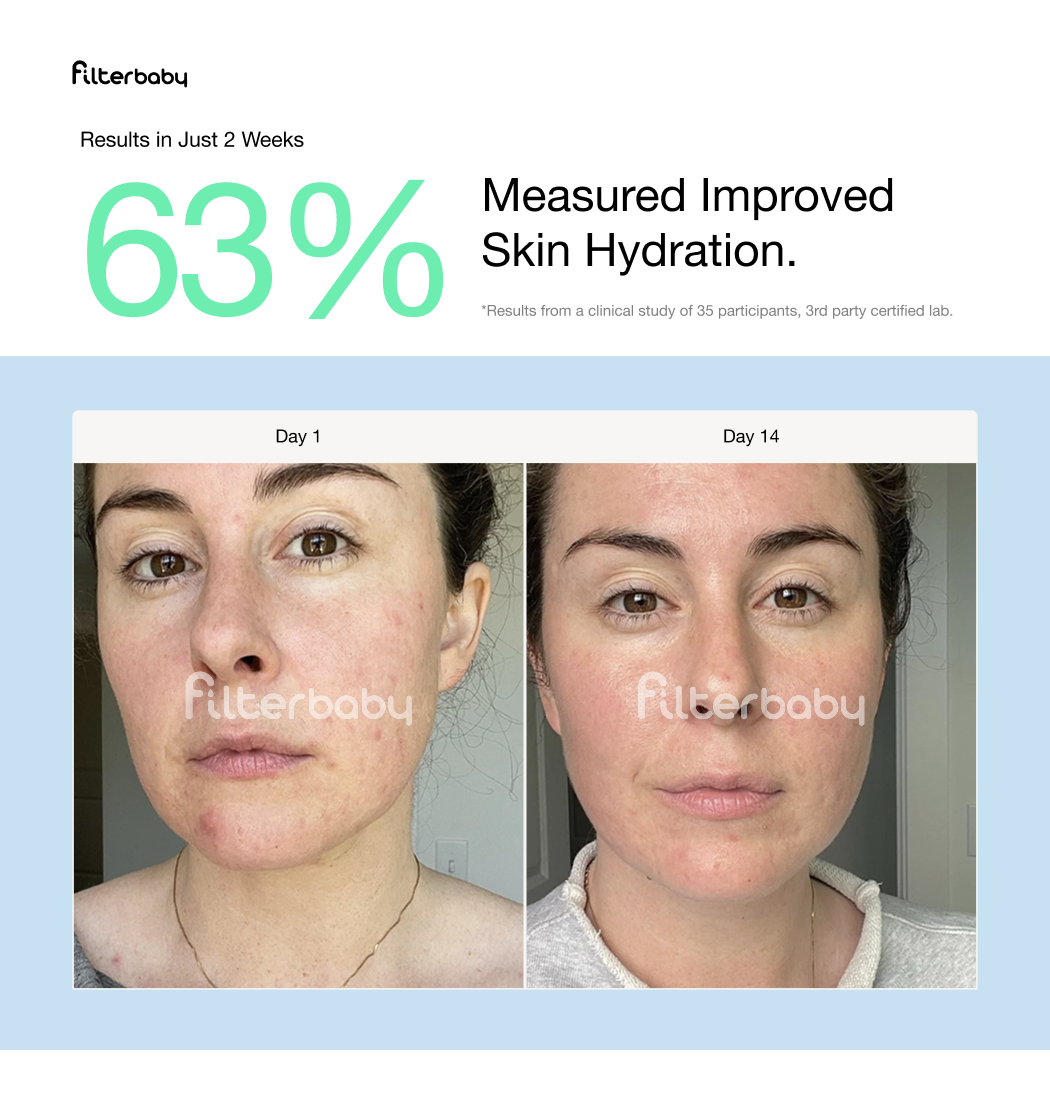 Filterbaby Skincare Faucet Filter 2.0